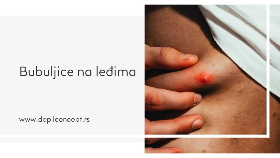 bubuljice na ledjima
